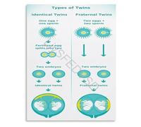 KCDFDVJFBM Twin Pregnancy Development Placentation Chart Poster Educational Wall-Art Canvas for Hospital and Nursery Decor(Framed,08x12inch(20x30cm))